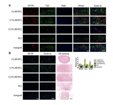 (a) nf200和tuj1免疫熒光染色觀察不同bp基支架和自體移植物組再生的